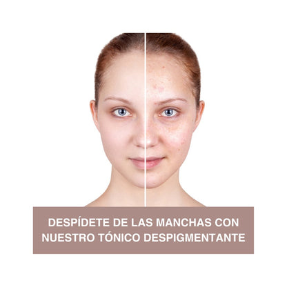 Elimina Manchas y deja tu rostro Radiante | LB Tonico facial - Beauty GloLB